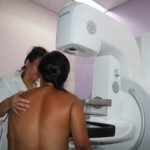 FCecon-mutirao-de-mamografias-FOTO-Lais-Pompeu-FCecon-1
